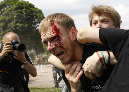 Russia, è gay: gli sparano a un occhio