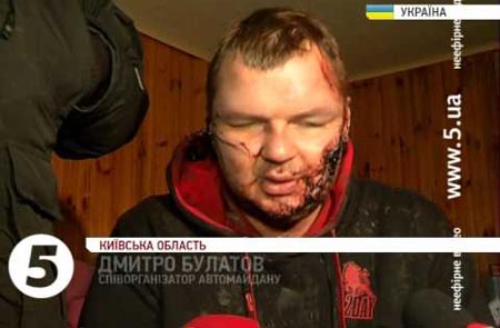 Amnesty International denuncia torture brutali ad oppositore ucraino