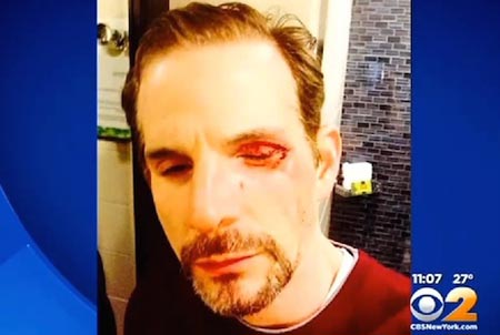 New York: cinquanta persone assistono ad un attacco omofobo, ma nessuno fa nulla