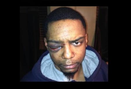 New York, ebrei ultraortodossi pestano un giovane omosessuale