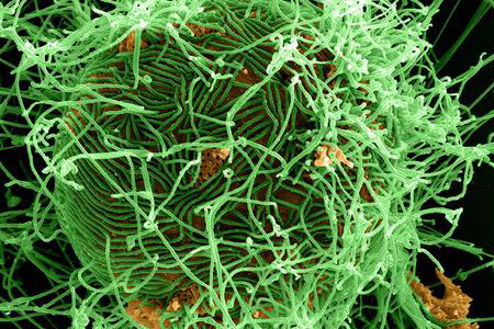 Ebola potrebbe arrivare in Cina