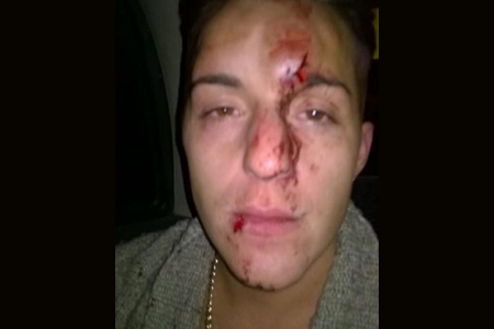 Cantano una canzone da “Wicked” sul bus, gruppo antigay li massacra di botte