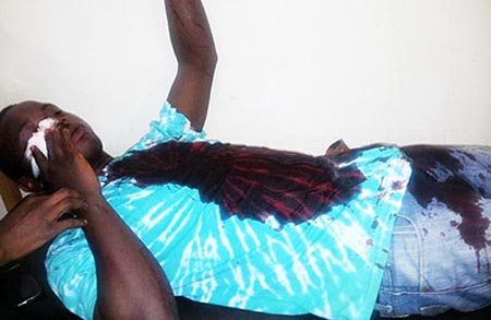 Uganda, selvaggiamente picchiato l’attivista per i diritti LGBT Kelly Mukwano