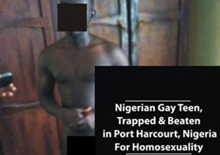 Nigeria, giovane omosessuale imprigionato e massacrato di botte da una gang inferocita