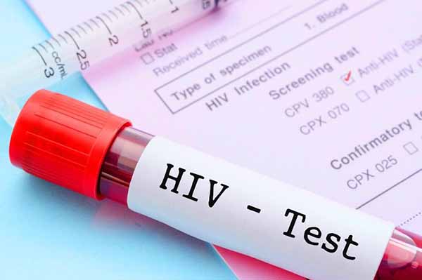 Hiv, il test diagnostico sbarca in farmacia