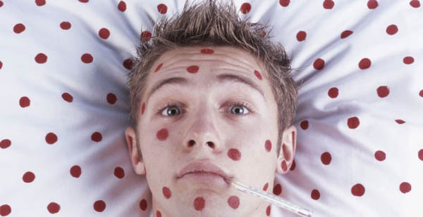 #Visioni di Mila Mercadante: gli allarmi sul “morbillo all’Americana”, cioè nessuna epidemia