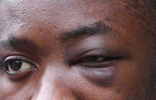 Forza Italia: “Basta con gli ipocriti buonismi della sinistra!”… Meglio le chiare intolleranze veterofasciste della destra, no?