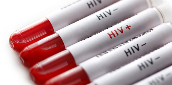 According to Human Rights Watch, Russia’s “Gay Propaganda” Censors Attack “ParniPlus” Health Website