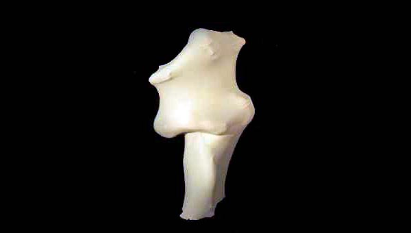 Due miliardi e mezzo di individui dimenticati #Milapersiste, il blog