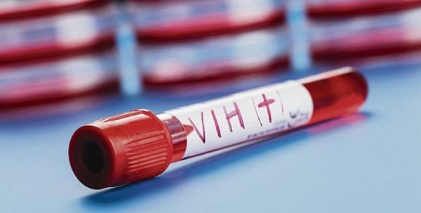 Hiv & Aids, la Toscana verso la nuova commissione regionale