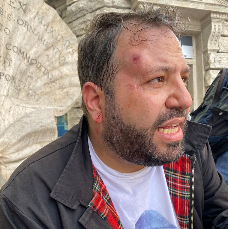 Sullo stato di salute della nostra democrazia c’è tanto da dire….